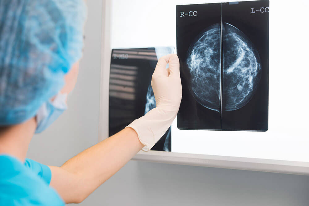 A radiologist examines an X-ray in this image. Mammogram testing can help identify areas of concern.